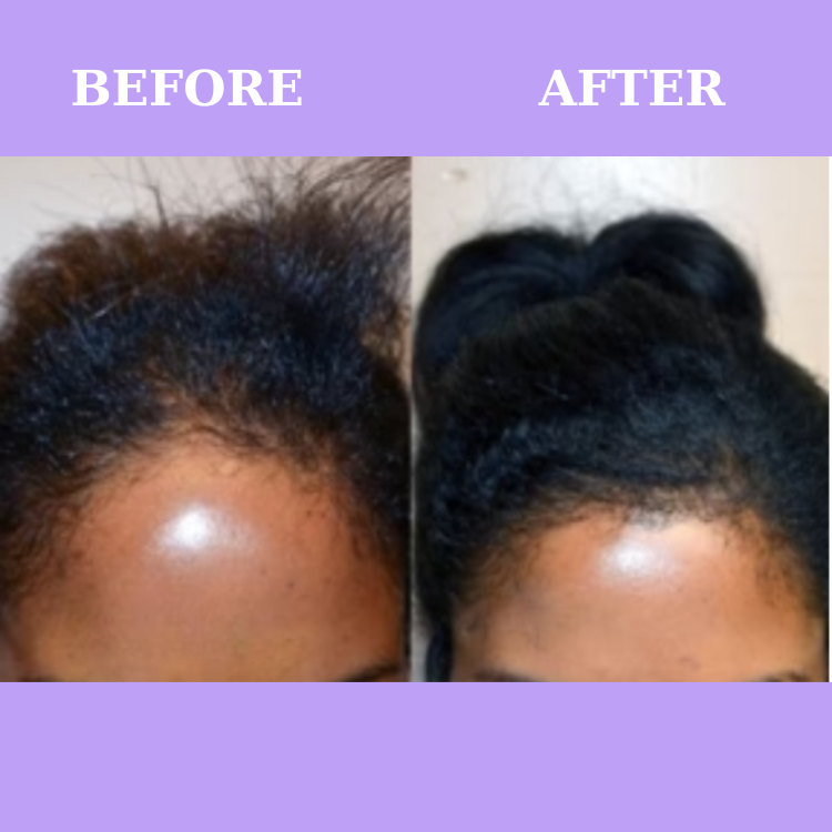 Verbalic Natural Hair Growth Supplement