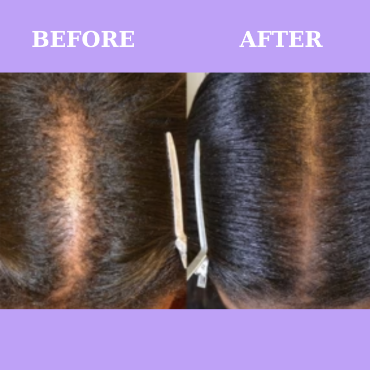 Verbalic Natural Hair Growth Supplement