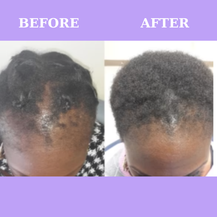 Verbalic Natural Hair Growth Supplement